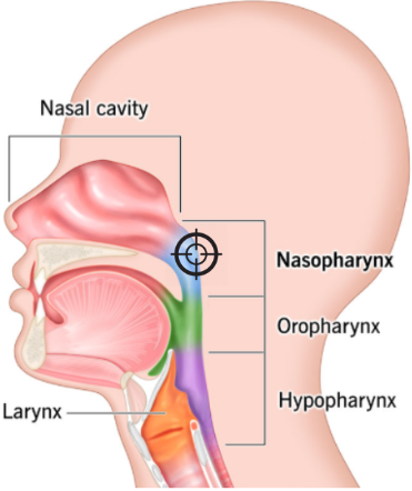 Diagram showing Colver targeting the nasopharynx